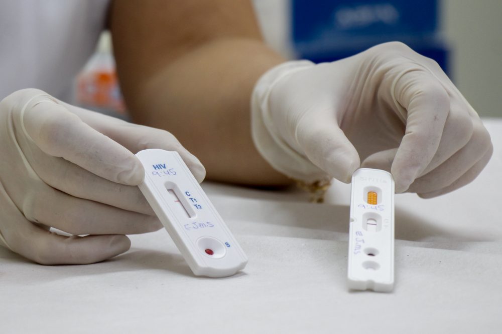 Prefeitura realiza testes rápidos de HIV e Sífilis nas unidades básicas de saúde